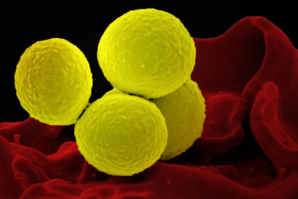 Evoluția rapidă a microbului Staphylococcus aureus pe pielea afectată de eczemă: calea spre tratamente noi și eficiente